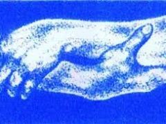 Disturbi da uso di sostanze